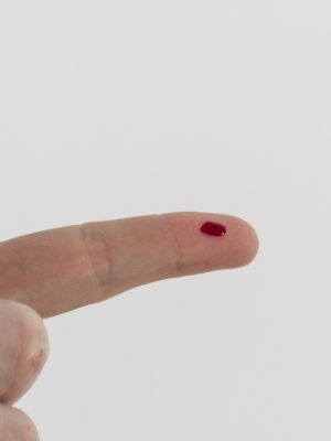 teste-hiv